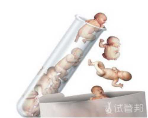 <b>济南有正规的机构可以做供卵试管婴儿吗？济南供卵机构名单？</b>